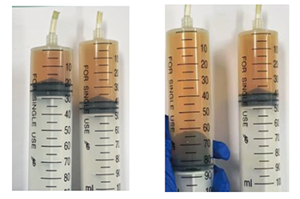 证据推理导向的二氧化氮针筒实验教学再设计<sup>*</sup>——压强对化学平衡的影响